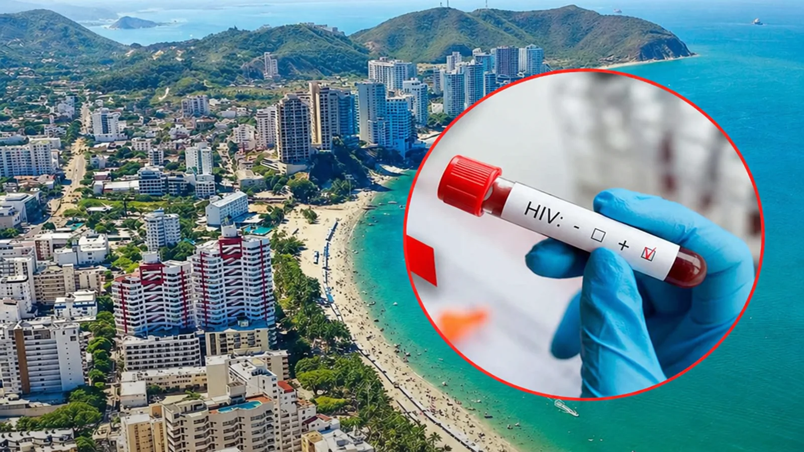 ¡Tengan cuidao pa’l Festival! 472 nuevos casos de VIH reportados en Colombia en este 2026, en el 2025 fueron reportadas 14.169 nuevas infecciones