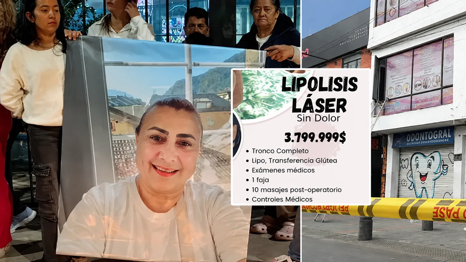 Entró a una cirugía estética y desapareció: el inquietante caso de Yulixa Toloza que hoy genera alarma en Bogotá