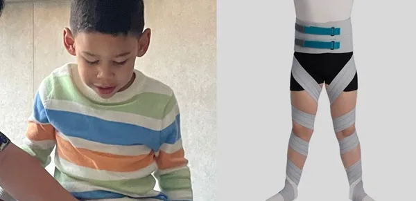 “‘Desde enero estamos esperando’: madre de niño con parálisis cerebral denuncia demora en entrega de dispositivo médico”.
