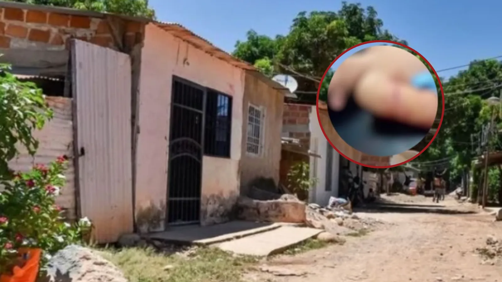 Mujer resultó herida con arma cortopunzante durante riña familiar en Valledupar.